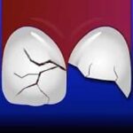 aplicaciones para odontología gratis ThoothSOS
